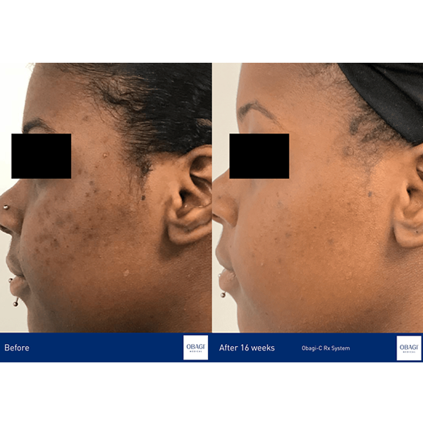 YouTopia Medical Aesthetics Clinic Obagi Skincare 2